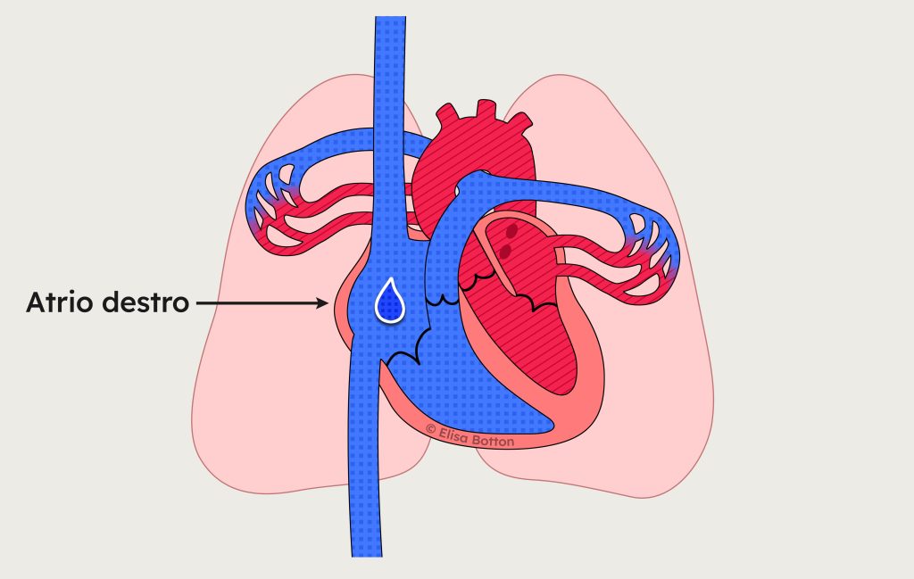 Atrio destro del cuore durante il riempimento con sangue venoso proveniente dalle vene cave.