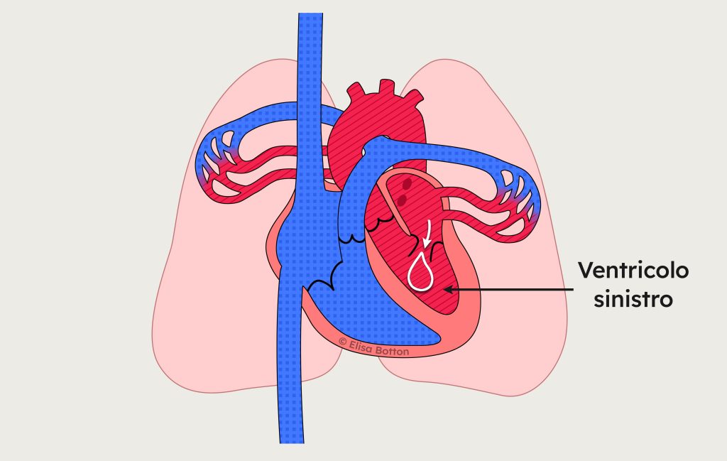 Ventricolo sinistro del cuore durante il riempimento con sangue ossigenato proveniente dall’atrio sinistro.